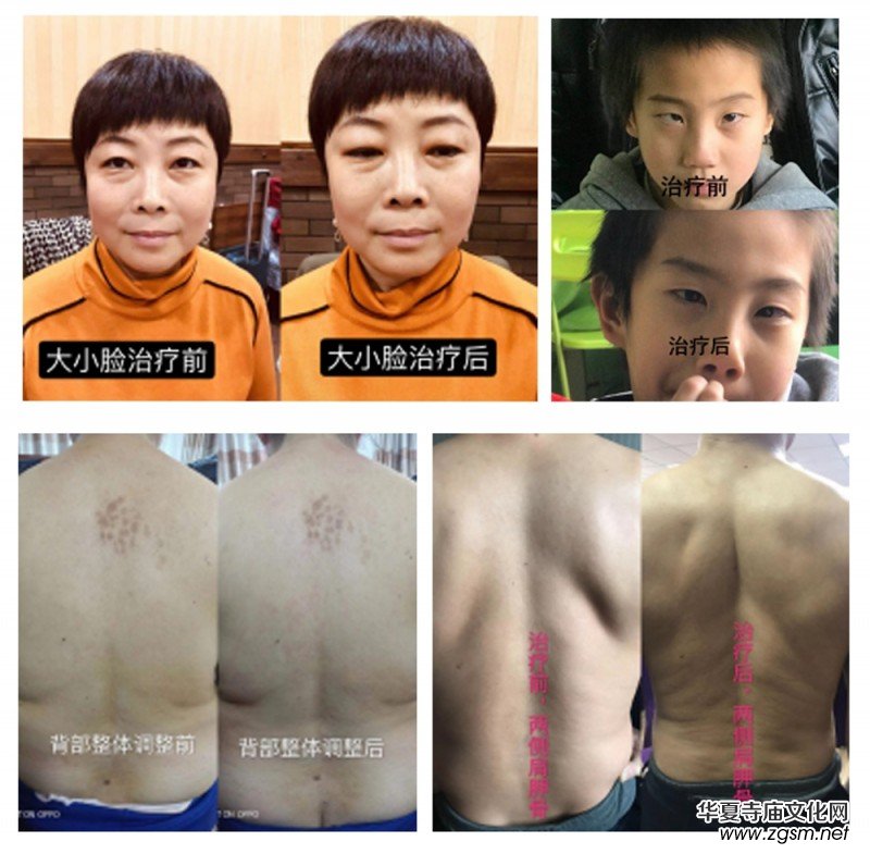 妙醫(yī)堂精手法傳承人——王浩丞 妙醫(yī)堂精手法傳承人——王浩丞