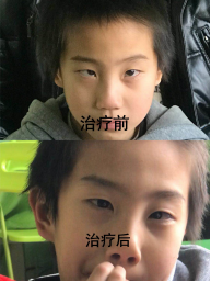 妙醫(yī)堂精手法傳承人——王浩丞 妙醫(yī)堂精手法傳承人——王浩丞