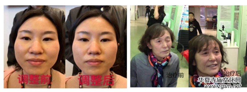 妙醫(yī)堂精手法傳承人——王浩丞 妙醫(yī)堂精手法傳承人——王浩丞