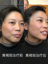 妙醫(yī)堂精手法傳承人——王浩丞 妙醫(yī)堂精手法傳承人——王浩丞